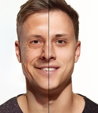Portrait eines Mannes, dessen rechte Gesichtshälfte gesund ist, während die linke Seite Kollagen Mangel aufweist und stark gealtert aussieht